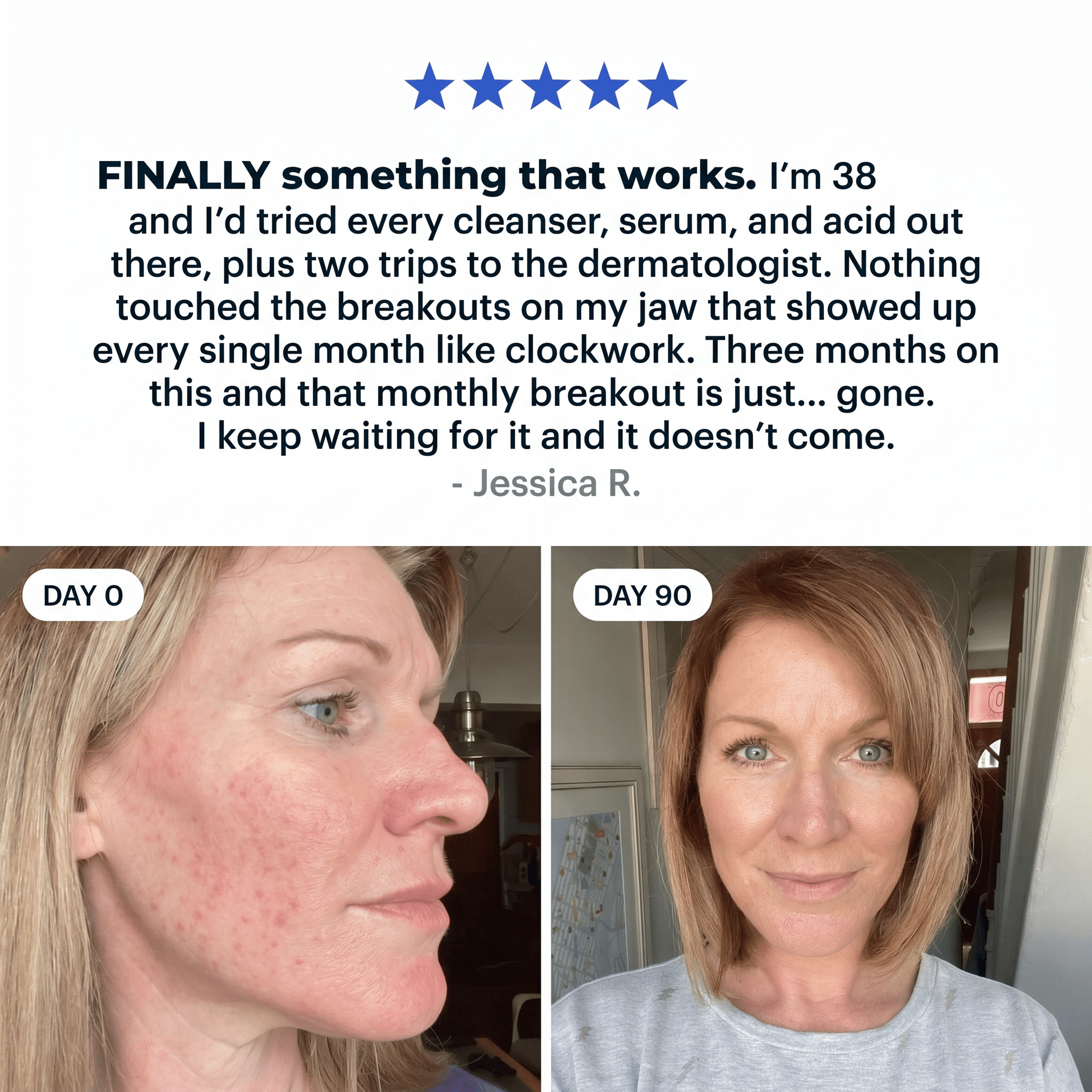 Coreva Labs Clear 3 - Hormonal Acne Support Supplement - Coreva Labs USA